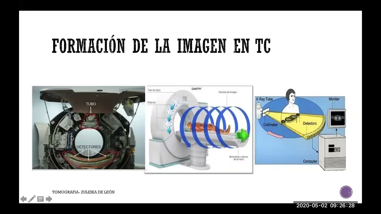 TOMOGRAFÍA COMPUTARIZADA- PARTES DEL EQUIPO