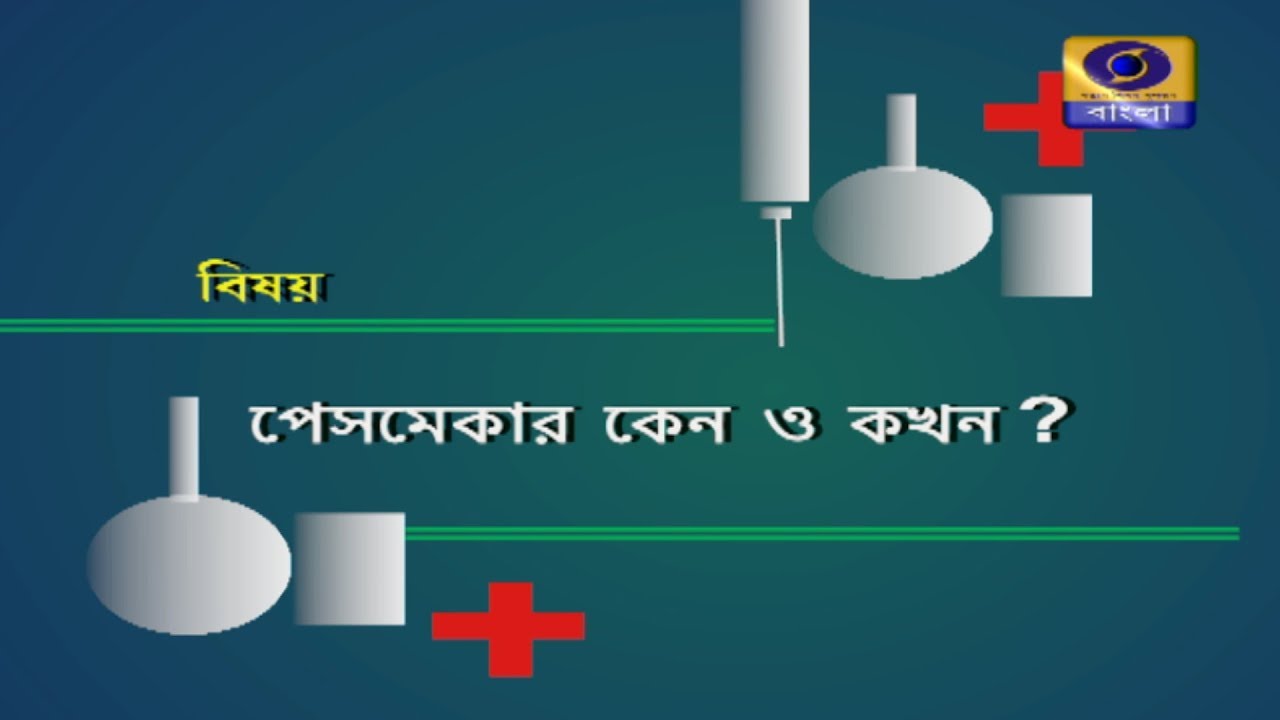 SUSWASTHA-পেসমেকার কেন ও কখন?