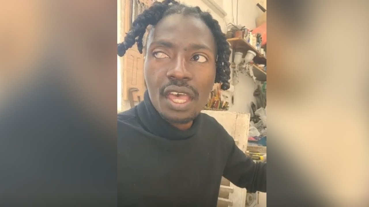 IAM MARWA EXCLUSIVE VIDEO WITHOUT GLASSES+ EXPLAINS HOW HE LOST HIS EYE AND TEETH #iammarwa #live