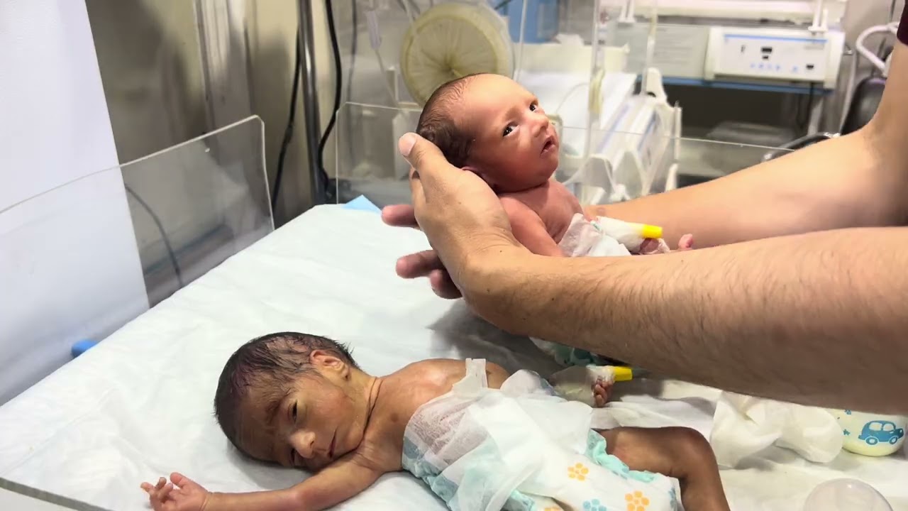 Improvement Journey of Cute Twin Babies | Fully Recovered & Now Taking Feeding 🍼💕