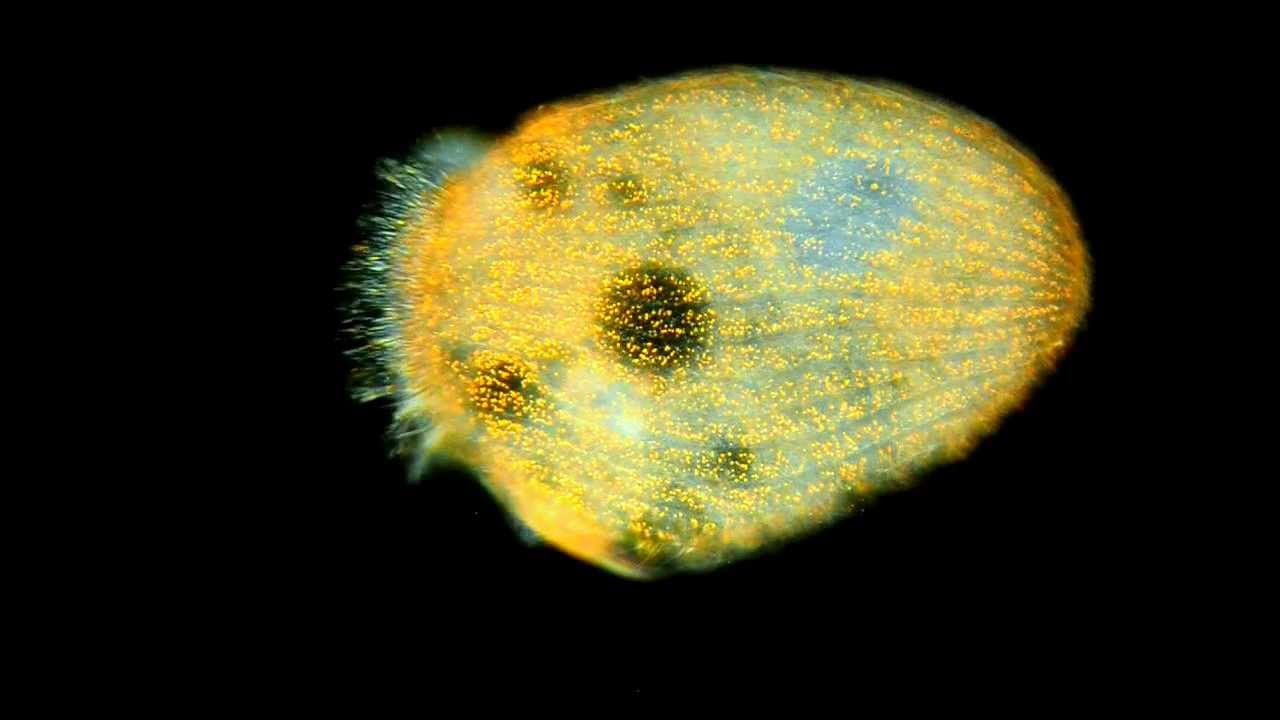 Amazing Microscopic HD Video! Protozoan With Beautiful Symmetry, 300x.