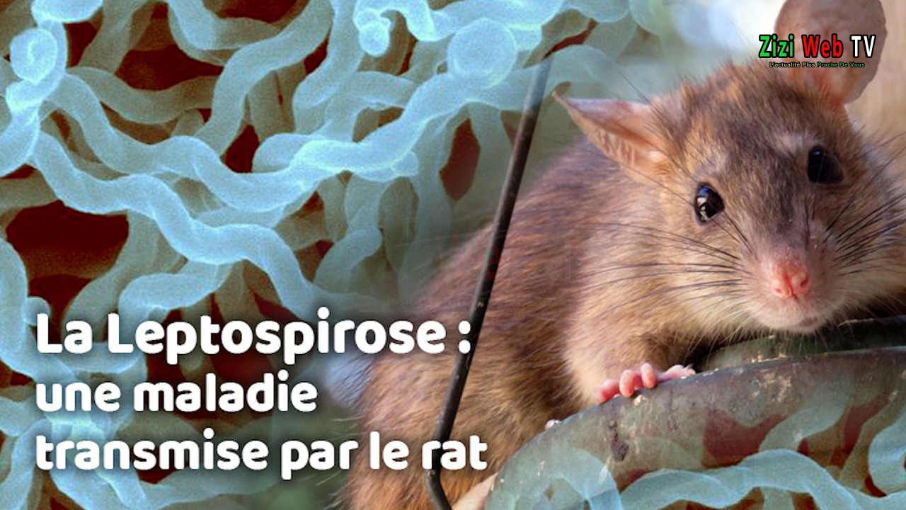 Tizi-Ouzou Enregistre Plus De 30 Contaminations Par Leptospirose … Les Détails …