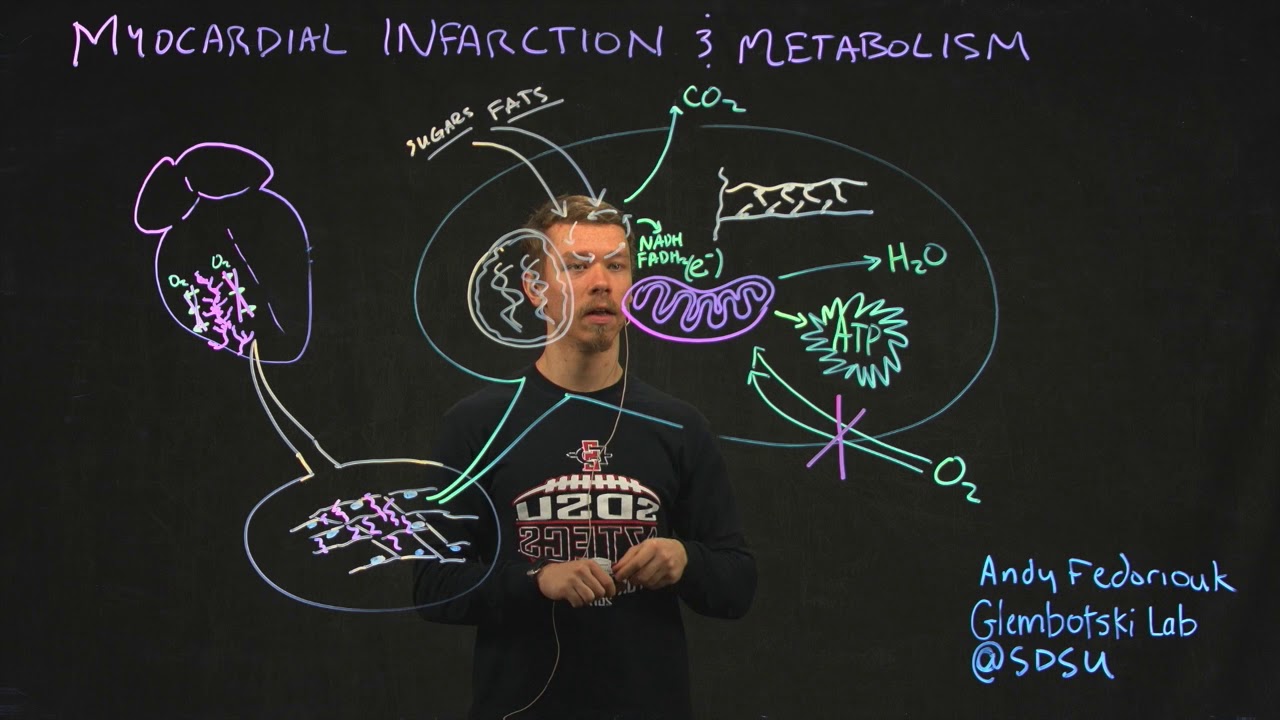 Myocardial Infarction & Metabolism, by Andy Fedoriouk