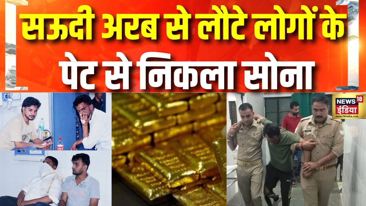 Gold Smuggling : पेट में भरकर सोने की तस्करी, सऊदी से लौटे सोना लेकर  | Hindi News