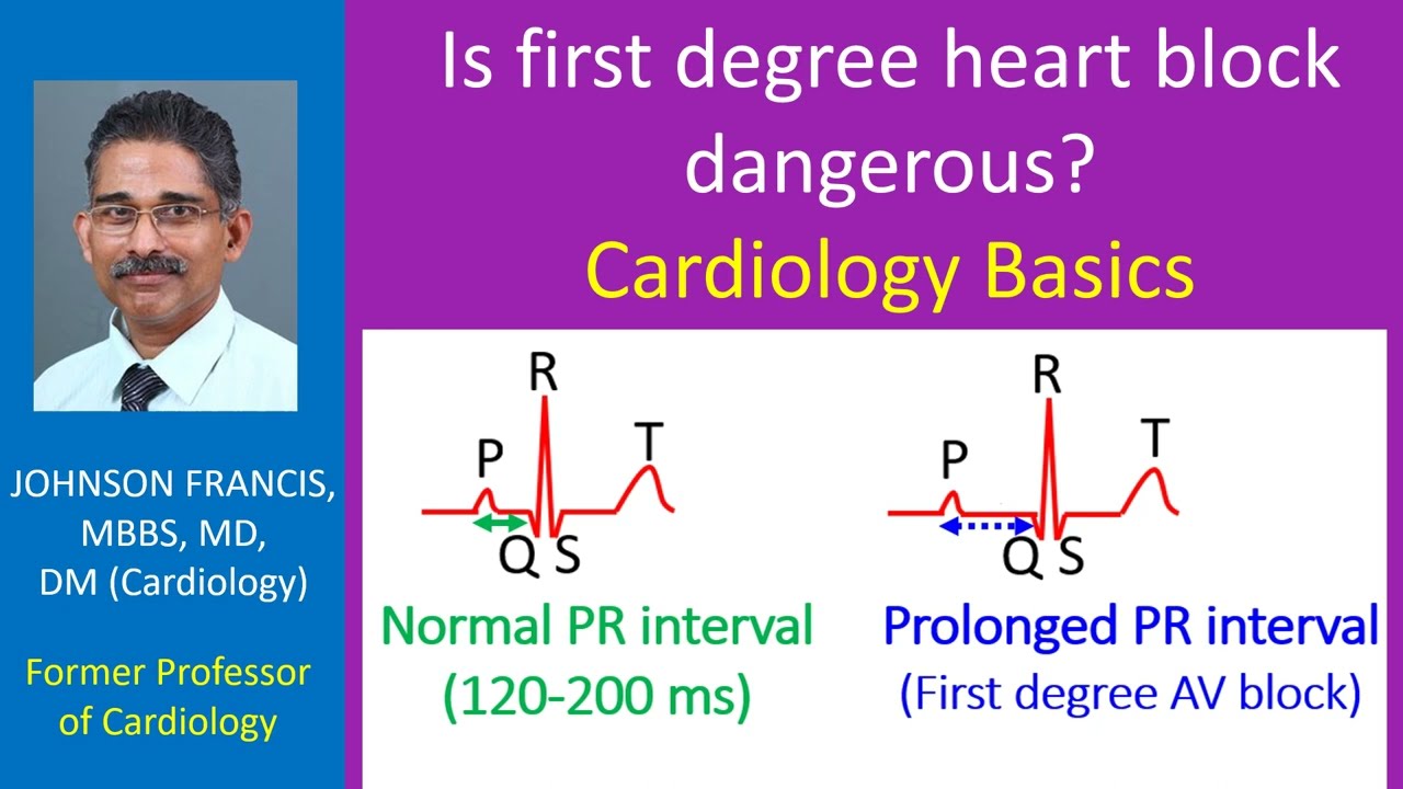 Is first degree heart block dangerous? Cardiology Basics