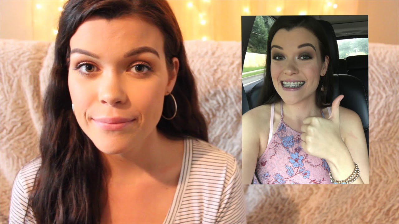 JAW SURGERY EXPERIENCE | 2 weeks post-op: physical and psychological impact of surgery