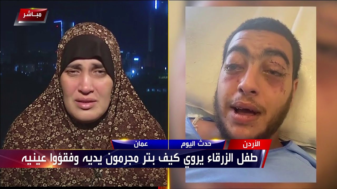 طفل الزرقاء يروي كيف بتر مجرمون يديه وفقئوا عينيه