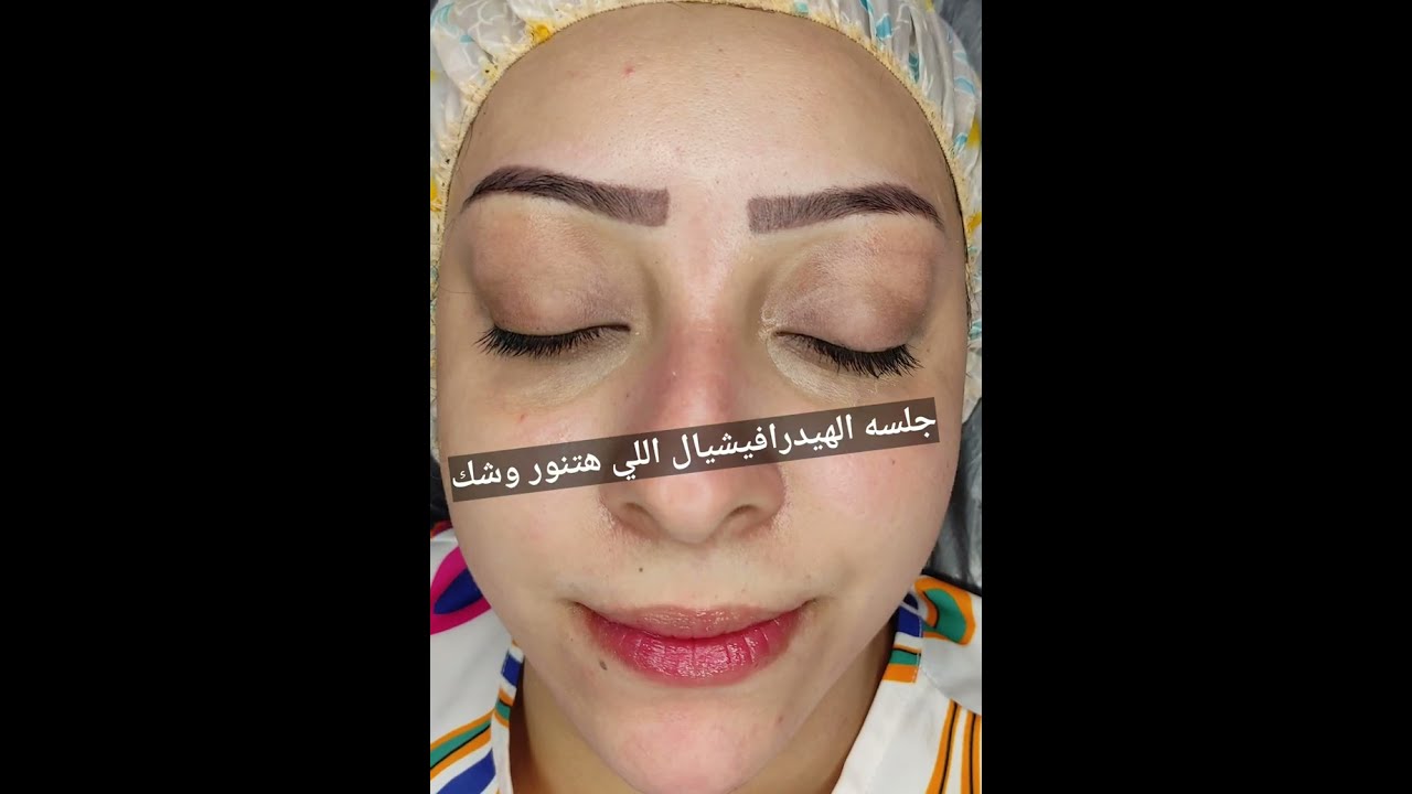 جلسه التنضيف العميق للبشرة بالأجهزة وجهاز الهيدرافيشيال اللي هتنور وشك 🌹