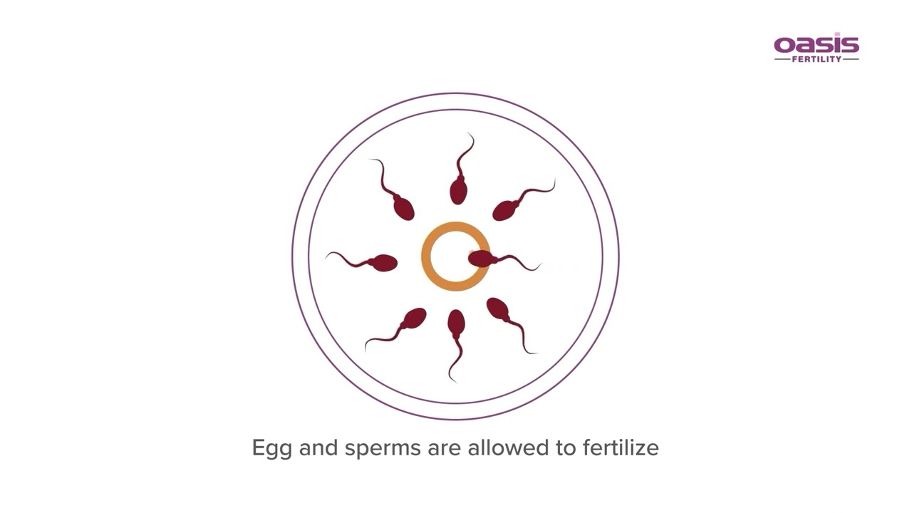 In Vitro Maturation (IVM) || Oasis Fertility