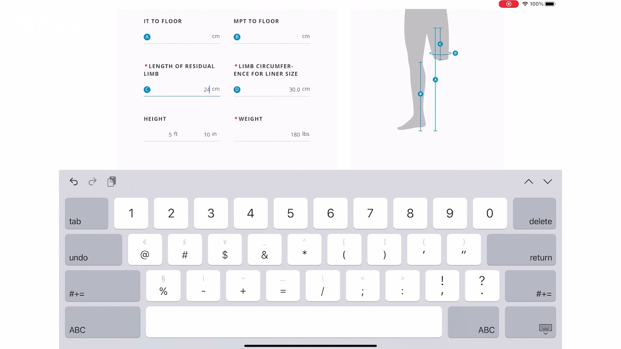 Measuring Transfemoral Limb for the Össur Portal