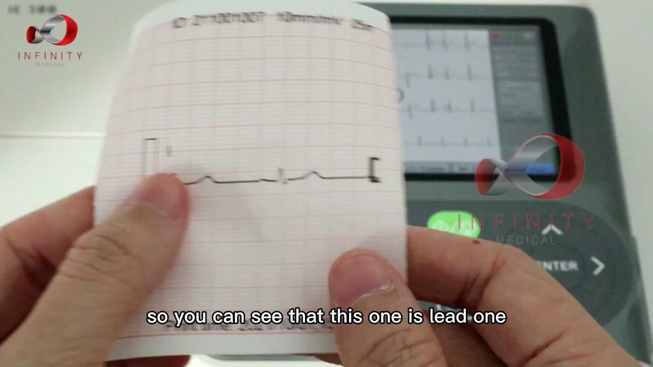 Biocare iE-300 ECG Digital 3-Channel ECG Monitor