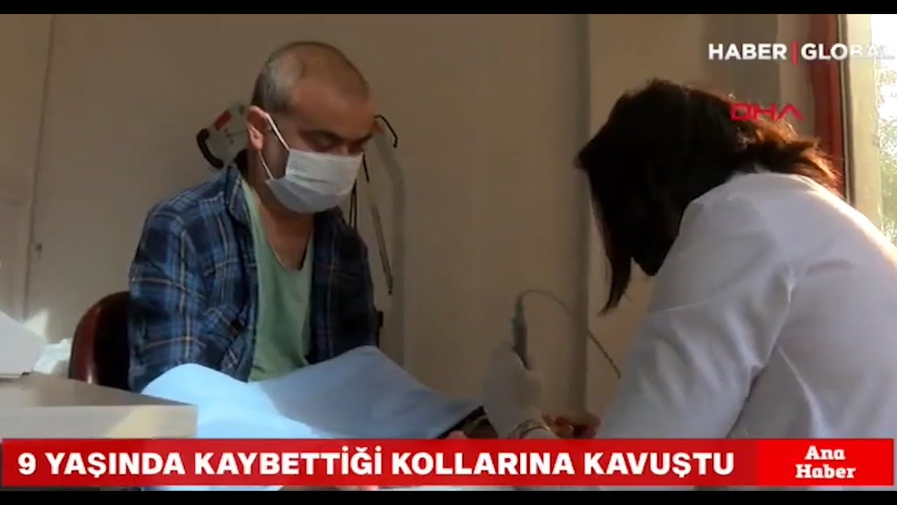 Çift Kol Nakilli Ayılmazdır'ın Fizik Tedavi Süreci Başladı