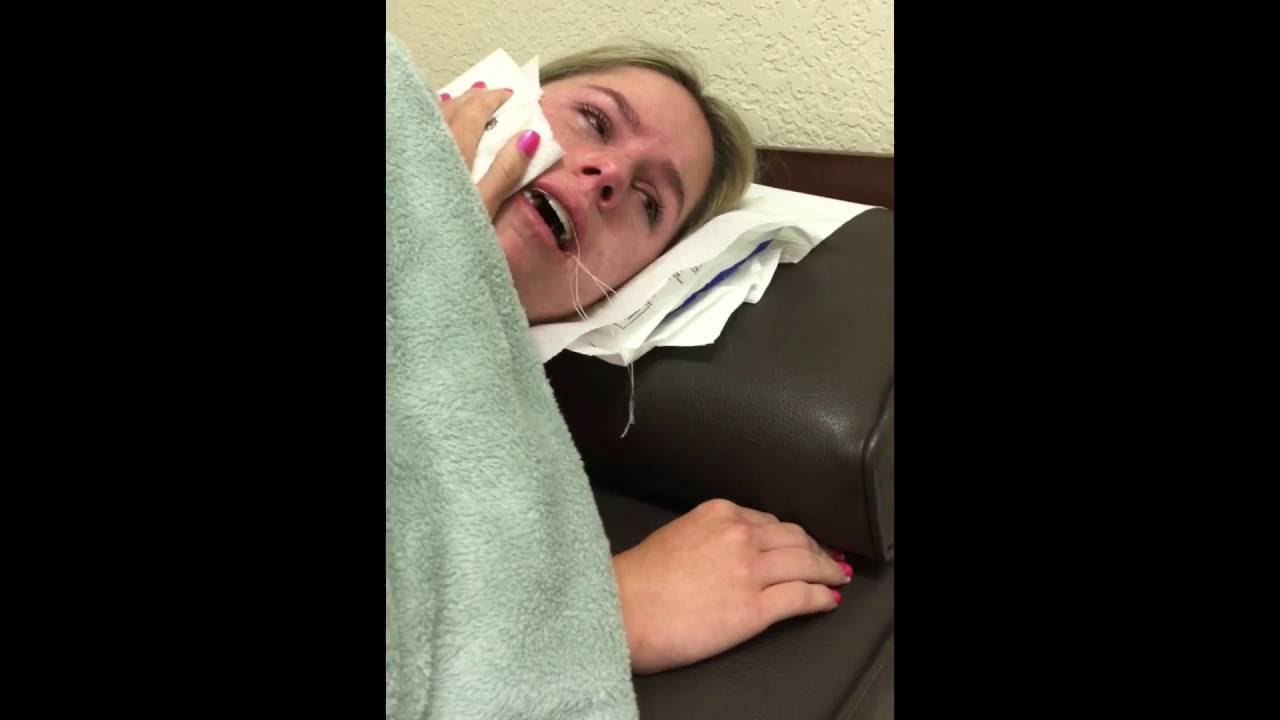 Hannah's Wisdom Teeth Removal Aftermath