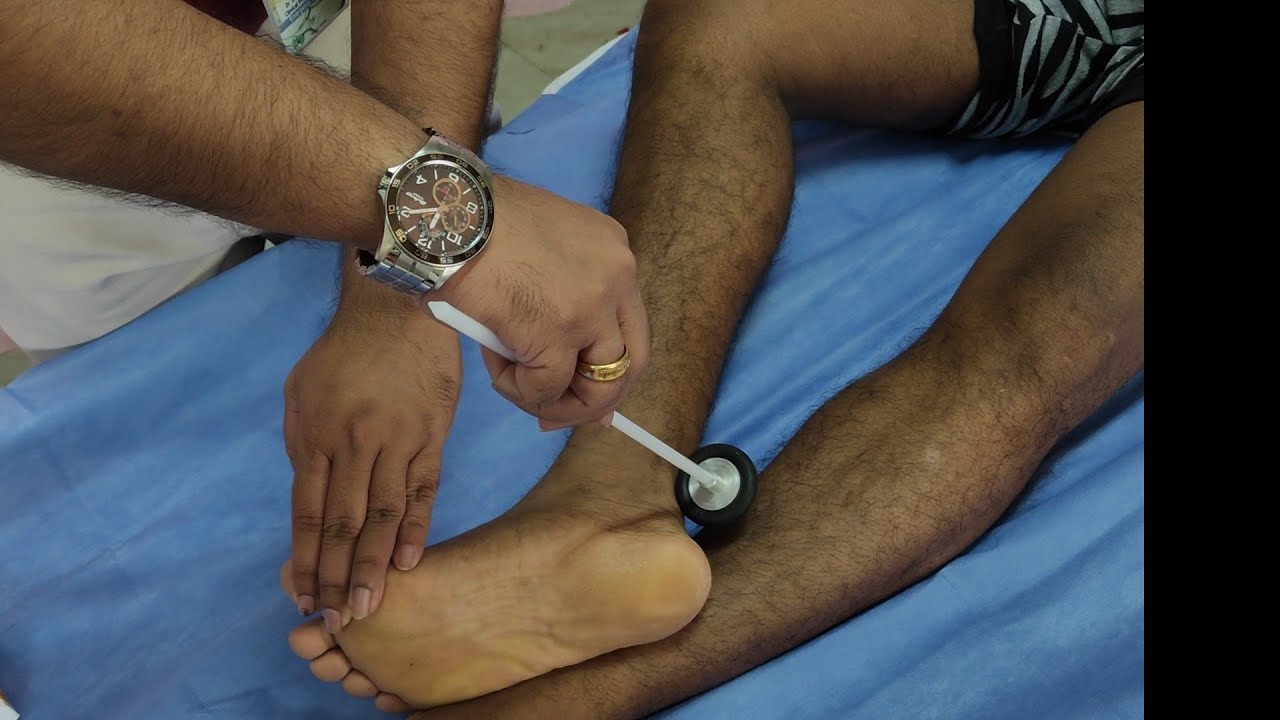 Deep Tendon Reflexes clinical examination ,by Dr Gireesh Kumar KP