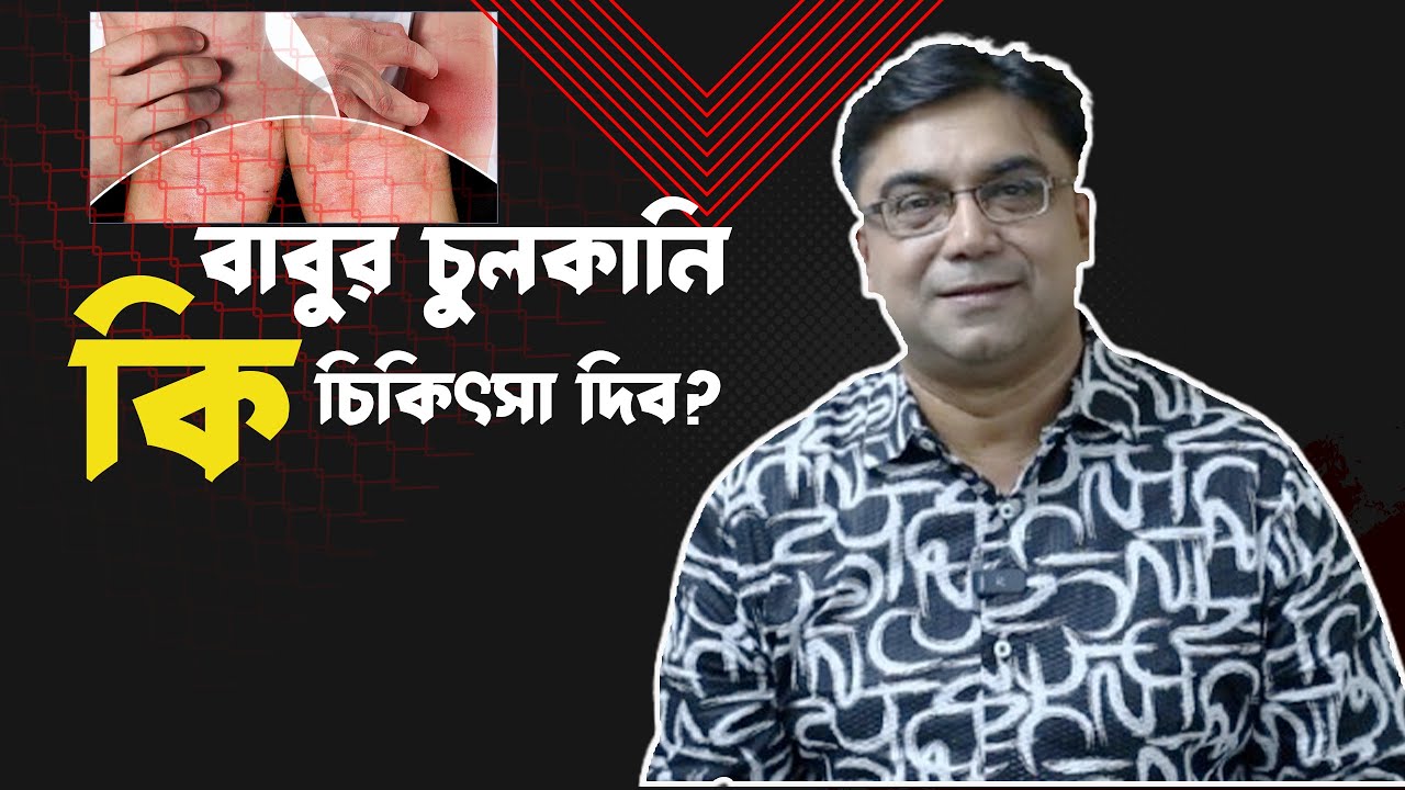 বাবুর চুলকানি কি চিকিৎসা দিব ? ডাঃ আহমেদ নাজমুল আনাম || FCPS, MD- Assistant Professor, ICMH