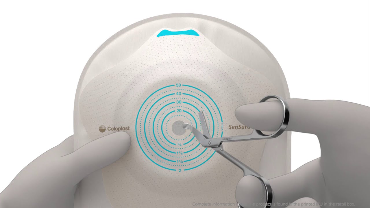 How to use SenSura Mio Convex Flip 1-piece urostomy