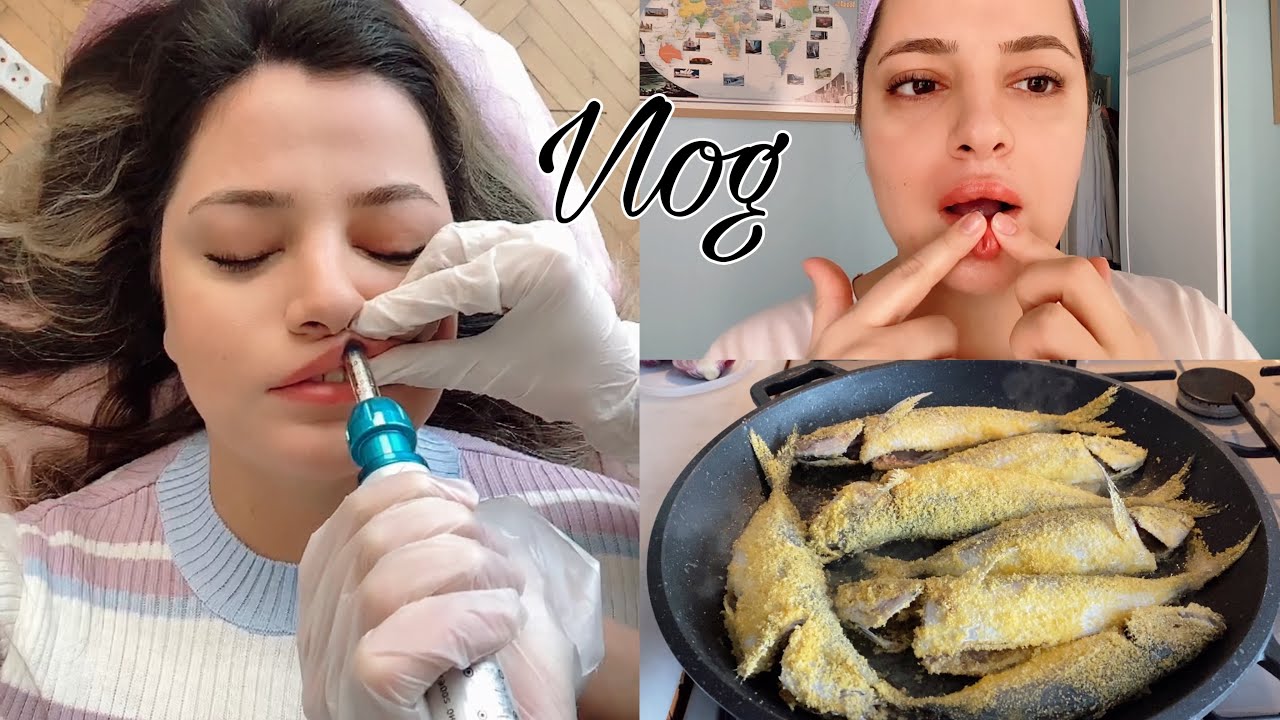 Vlog | İğnesiz Dudak Dolgusu 😱