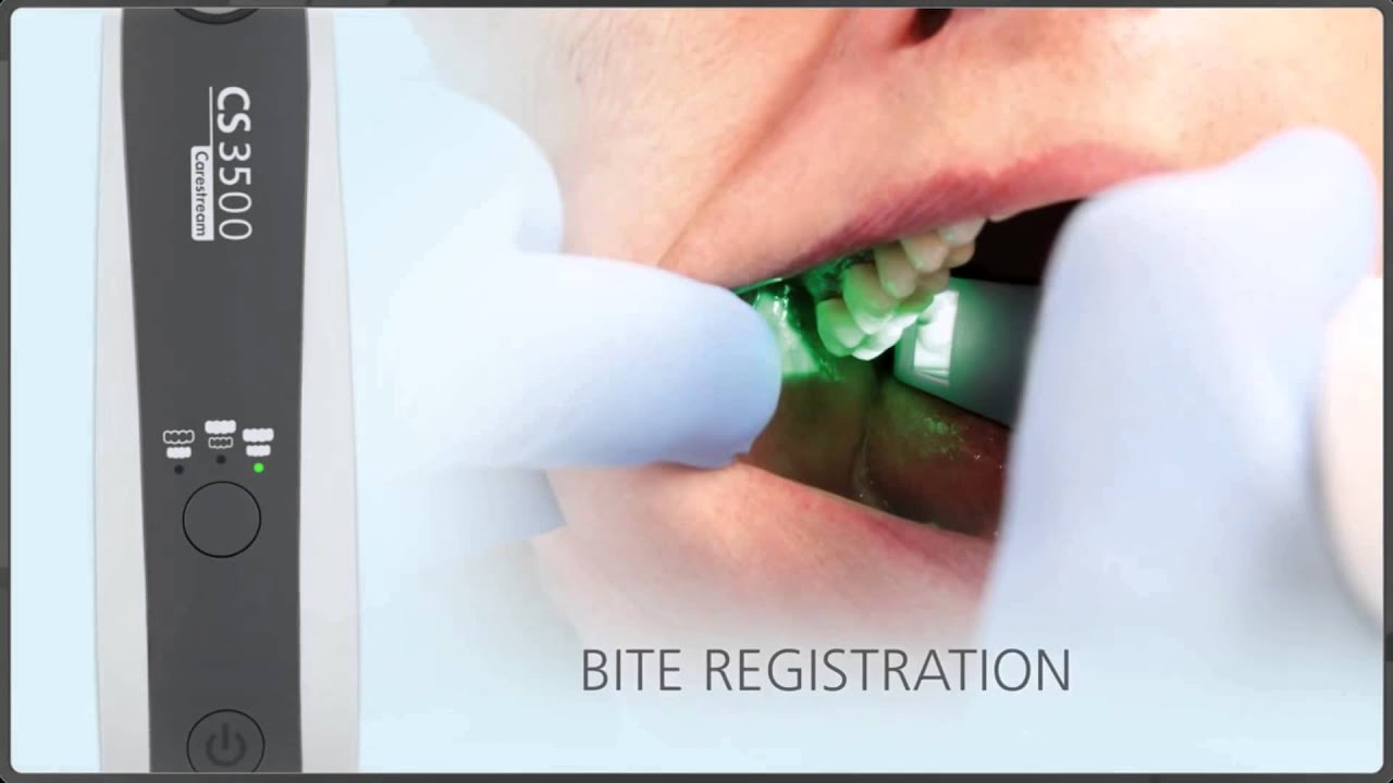 Carestream 3500 Intraoral Scanner