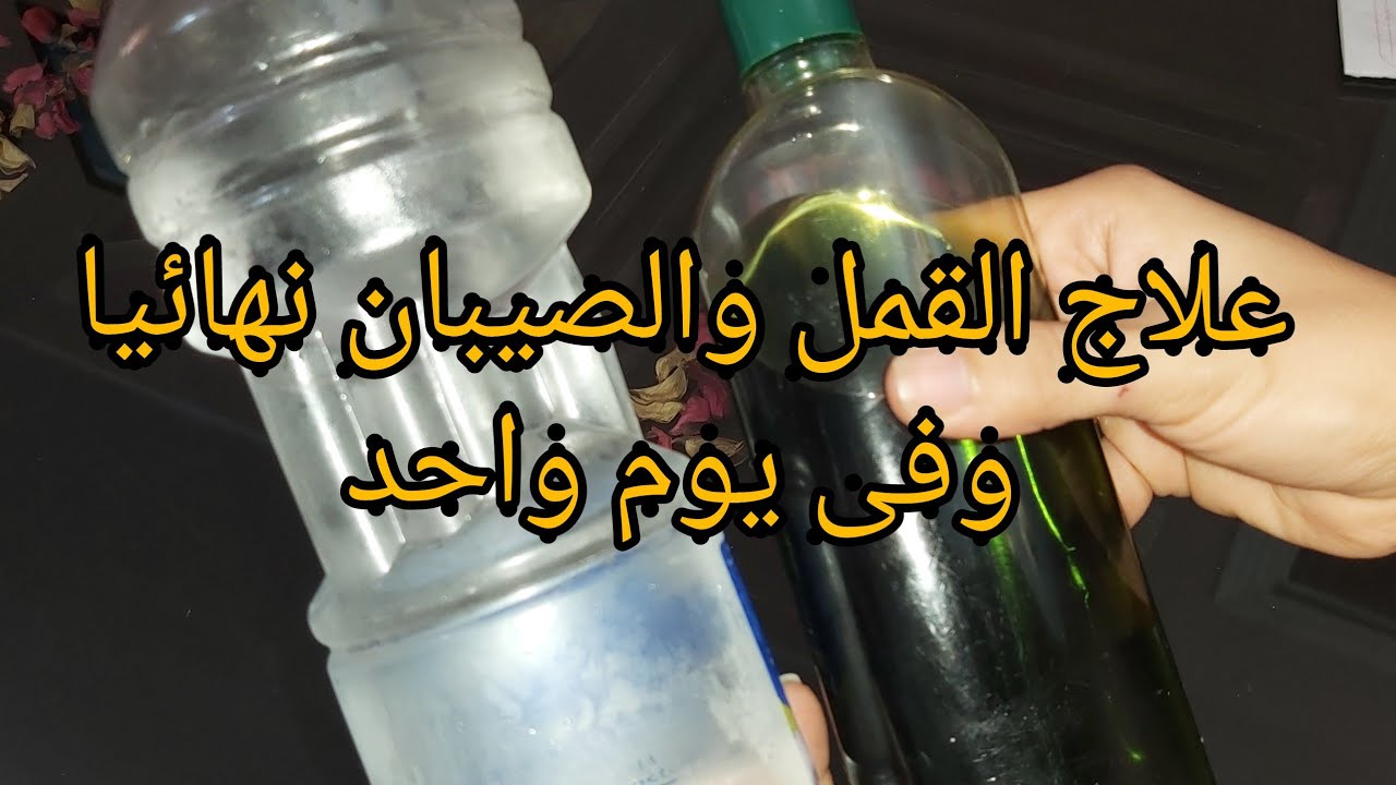 علاج القمل والصيبان نهائيا وفى يوم واحد على طريقة دكتور هانى الناظر