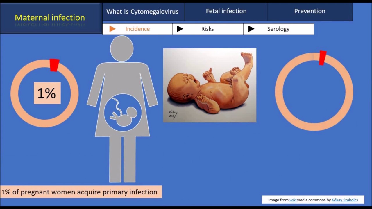 Cytomegalovirus during pregnancy