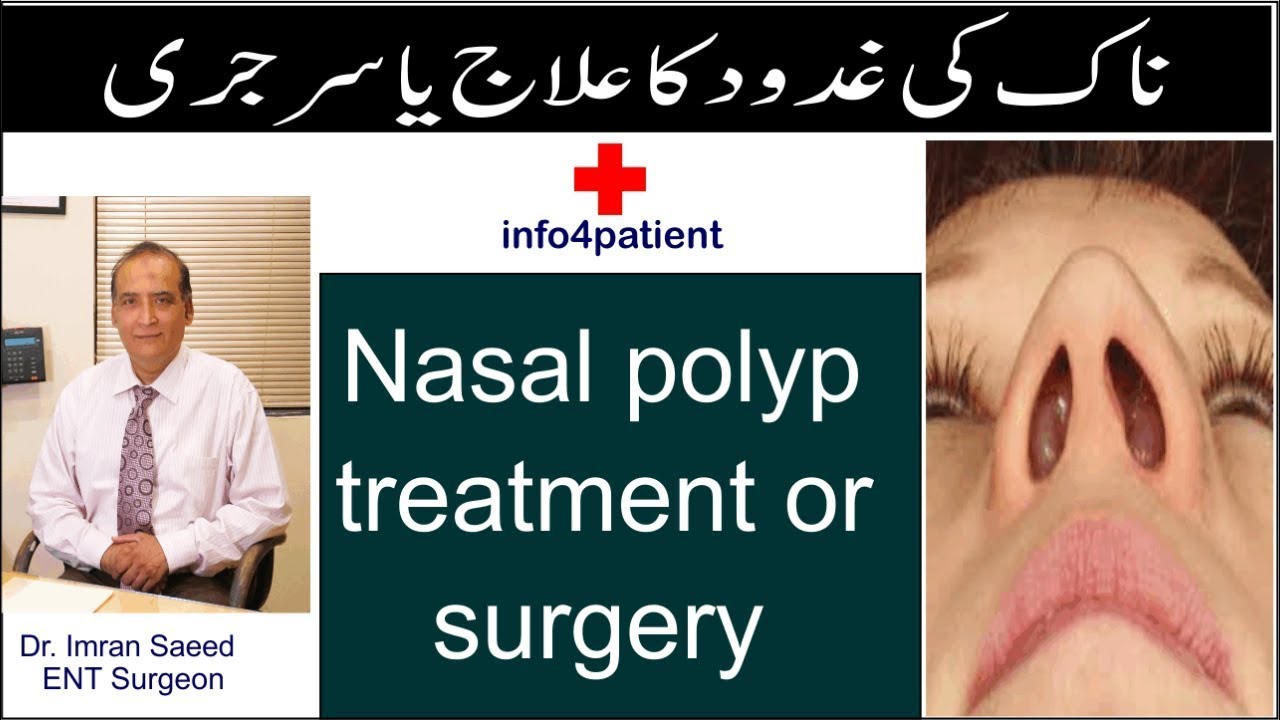 Naak Kay Ghadood - Nasal Polyp ka ilaj medicine ya surgery