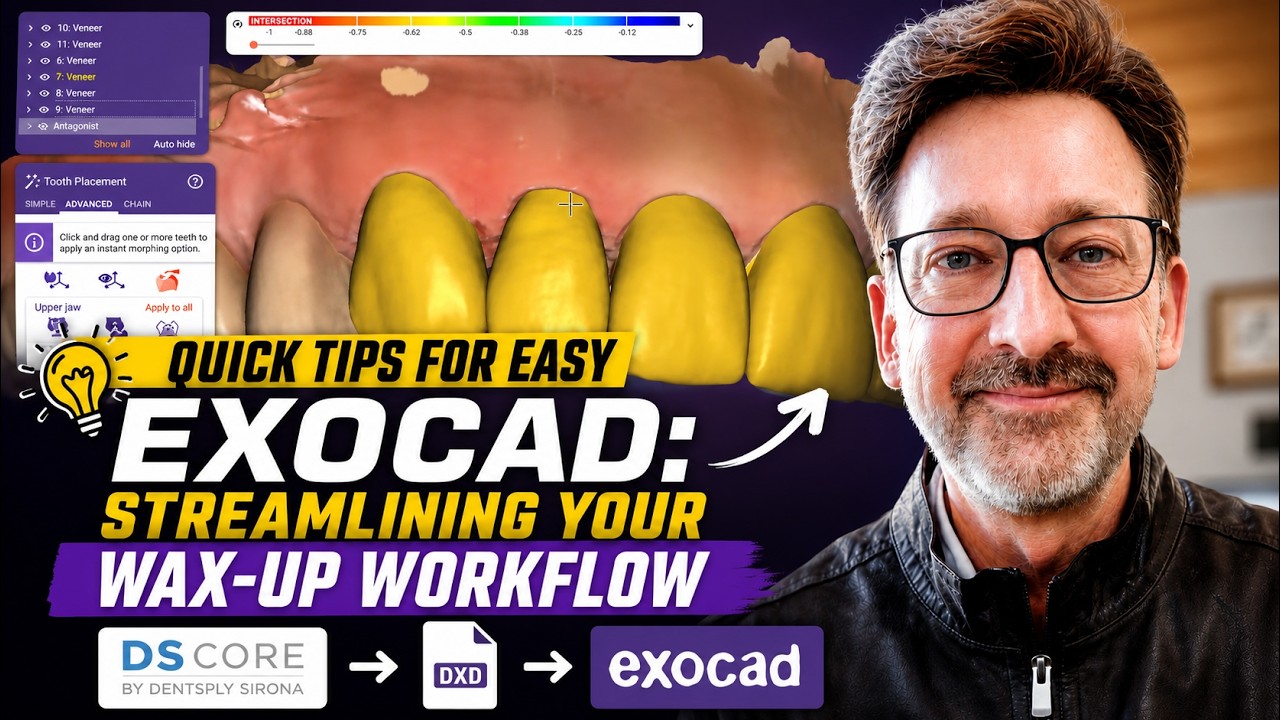 Quick Tips for Easy Exocad: Streamlining Your Wax-up Workflow