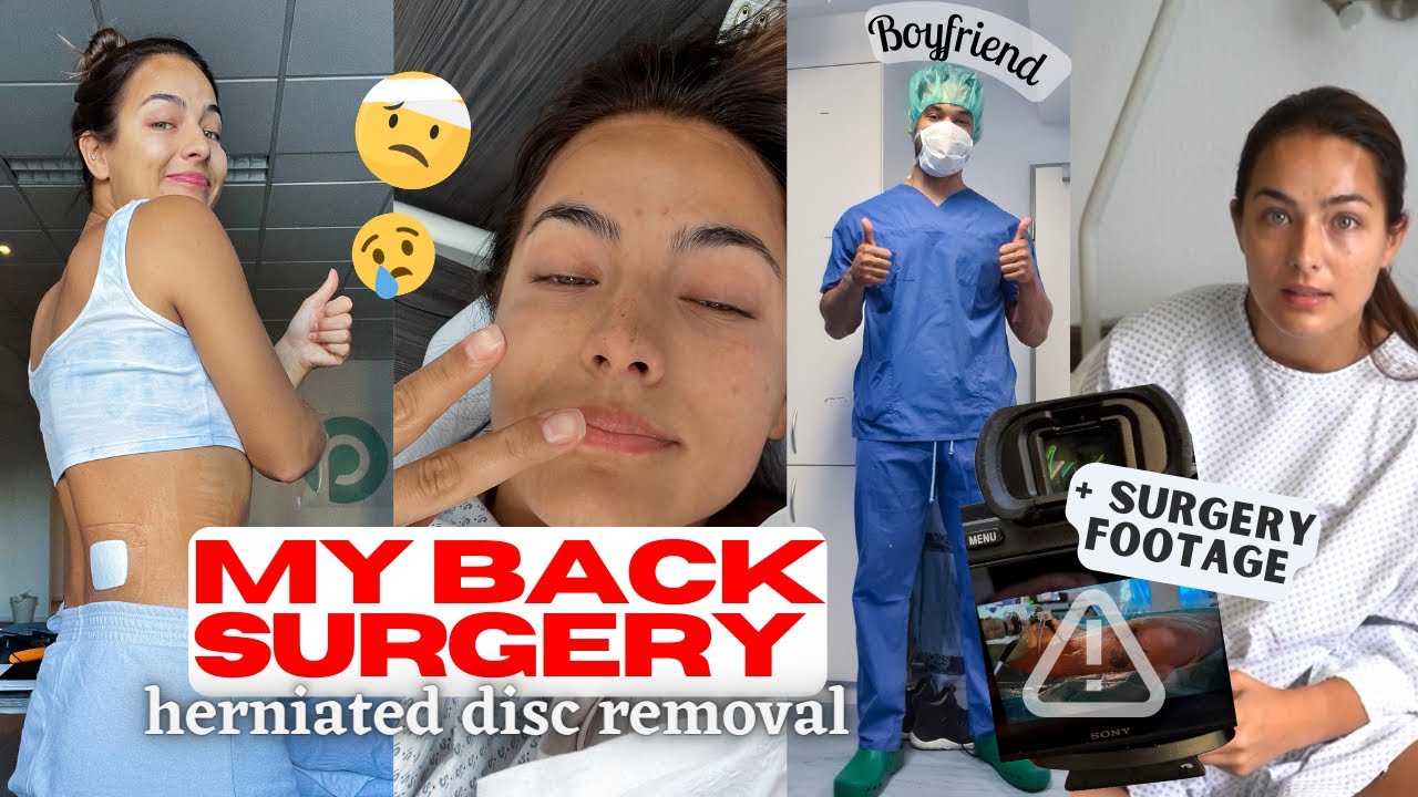MY SURGERY & FULL EXPERIENCE | Vlog, pain, results *HELP | episode 2