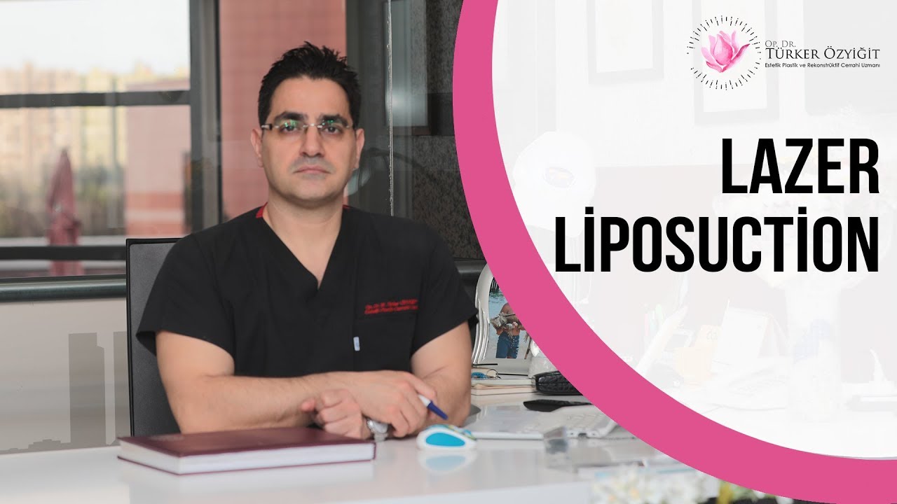 Lazer liposuction - Smartlipo - Op. Dr. Turker Ozyigit