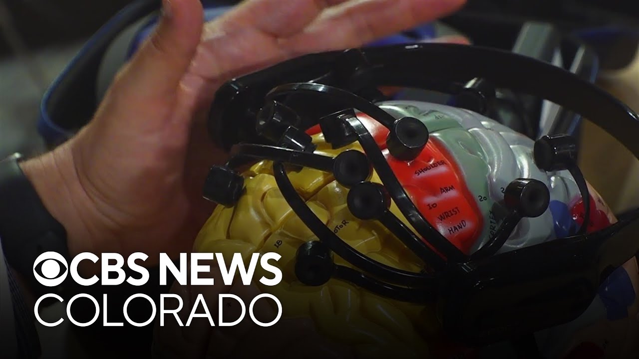 What’s the age of your brain? Neurotechnology study by a Colorado doctor has the answer