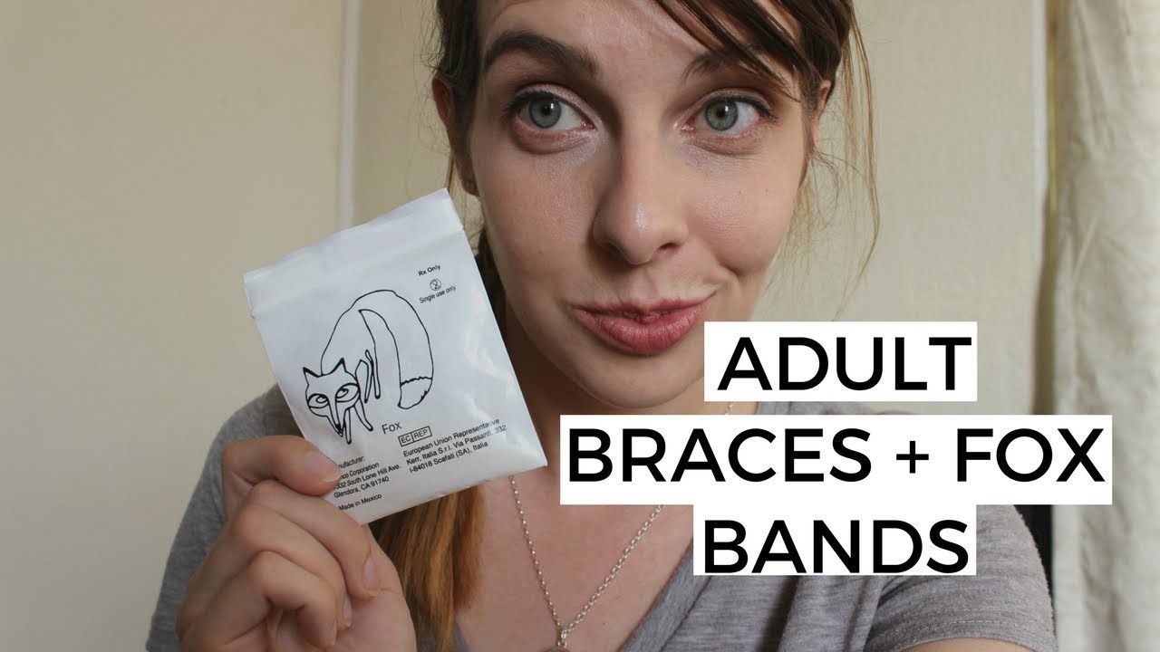 Adult Braces Update | My fox bands