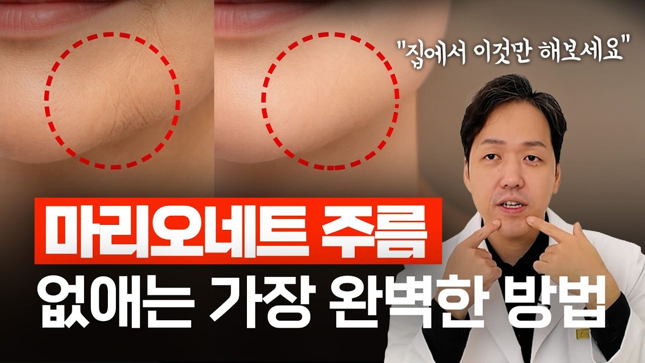 20년차 성형외과 전문의가 알려주는 수술없이 마리오네트 주름 없애는 법!