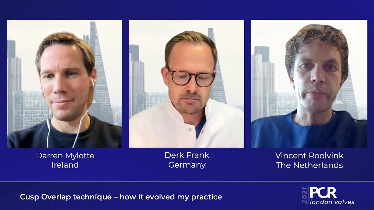 Cusp Overlap technique &ndash; how it evolved my practice - PCR London Valves 2021