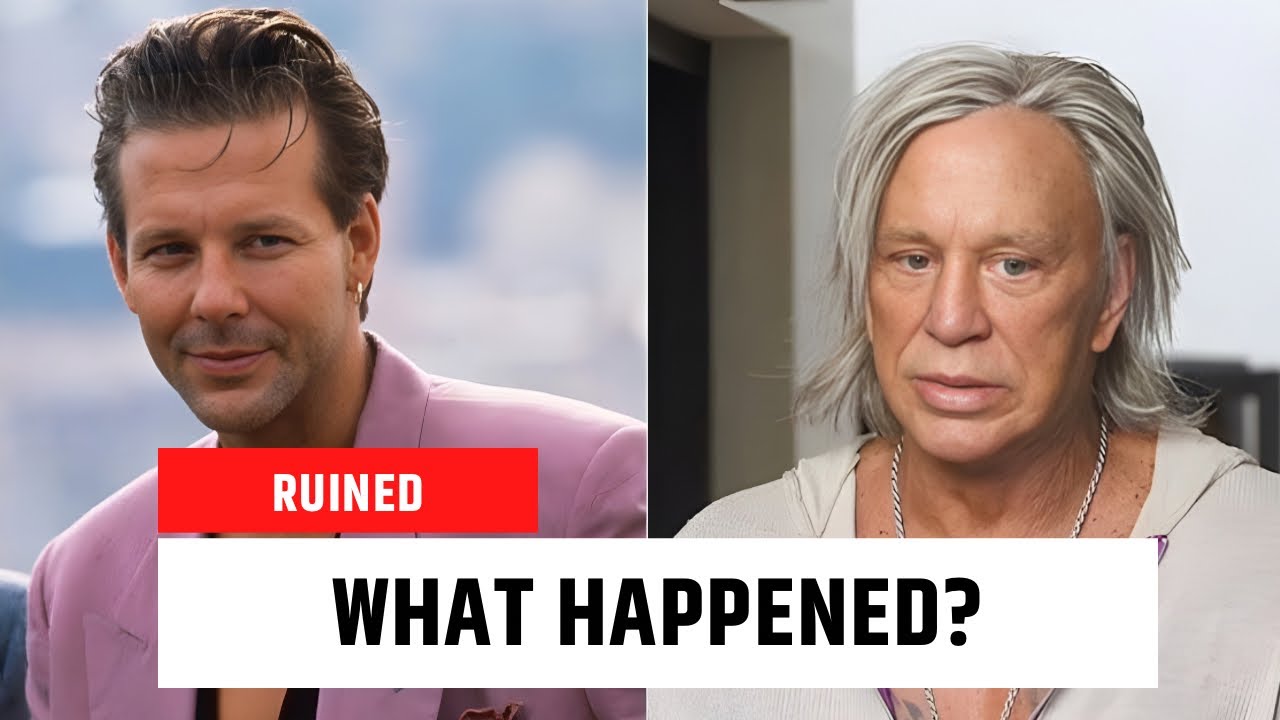 40 Hollywood Hunks Who Ruined Their Faces (Plastic Surgery Disasters) 😱