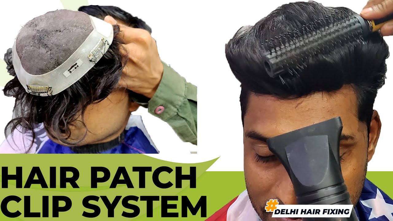 Hair Patch Clip System | Hair Patch Clipping System for Men in Delhi | Permanent Hair Patch