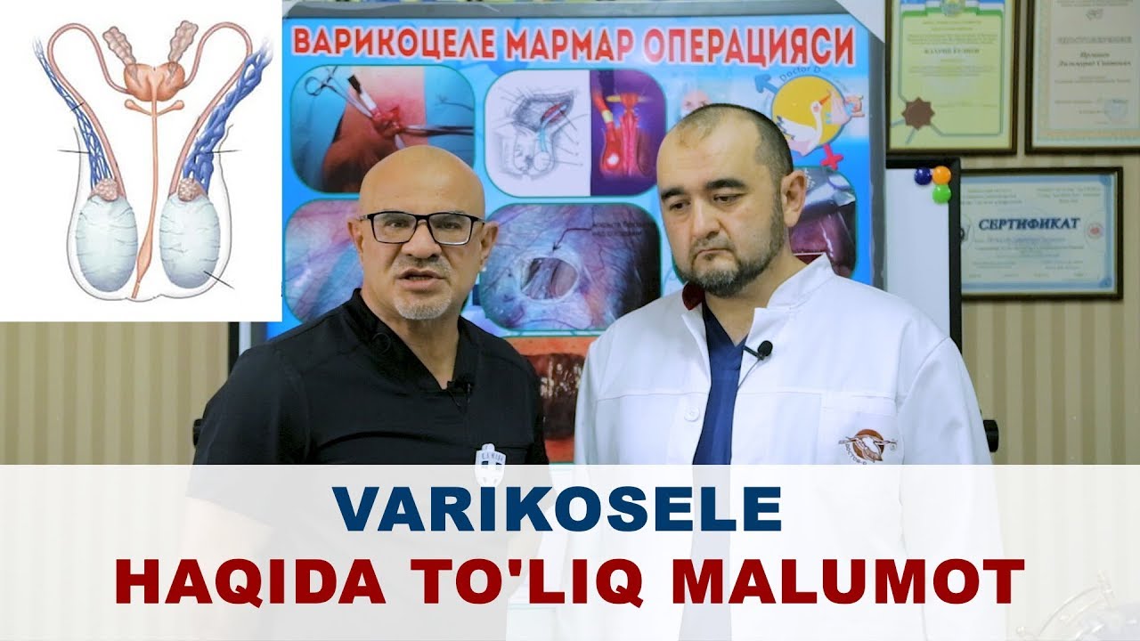 #100 DOKTOR D: VARIKOSELE HAQIDA TO'LIQ MALUMOT