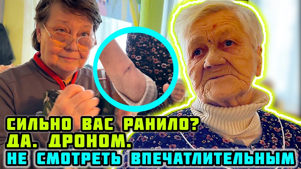 БЕЖЕНЦЫ. Осколок в лице. Осколки в руке. Не смотреть впечатлительным. Привезли помощь.🙏🏼