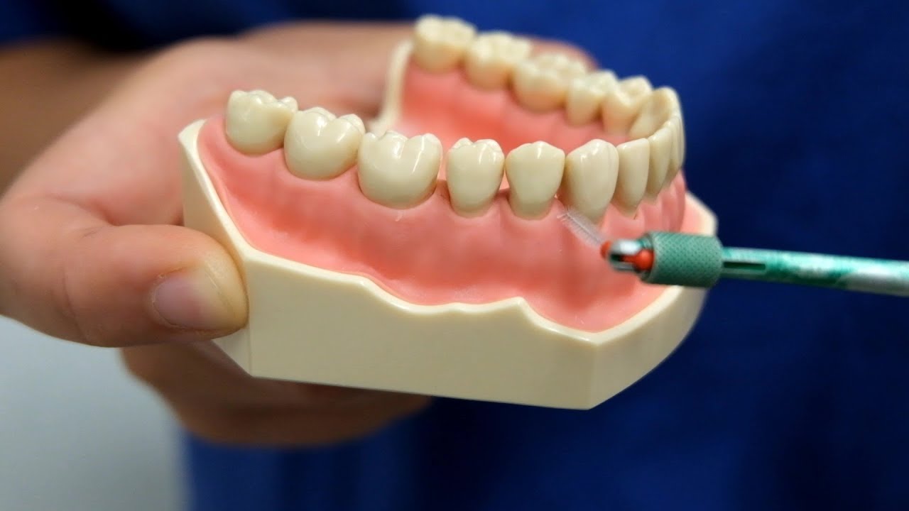 5 Tipps für die richtige Zahnpflege