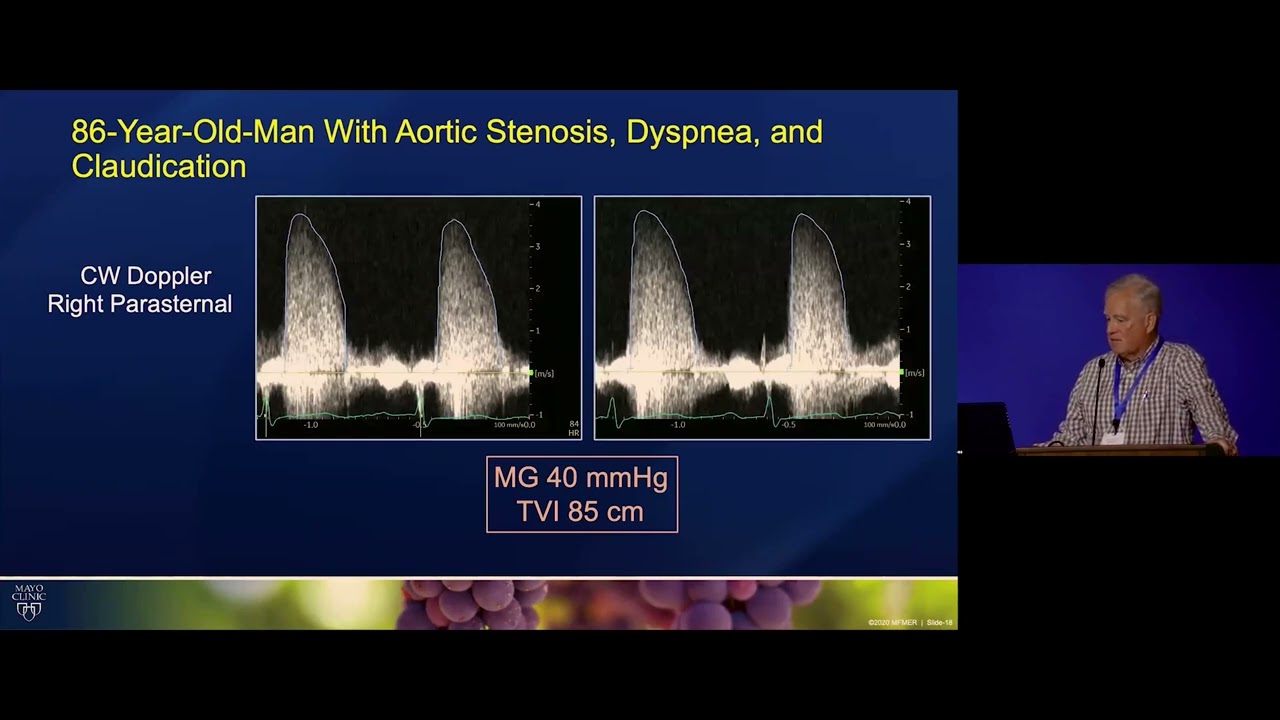 Severe Aortic Stenosis