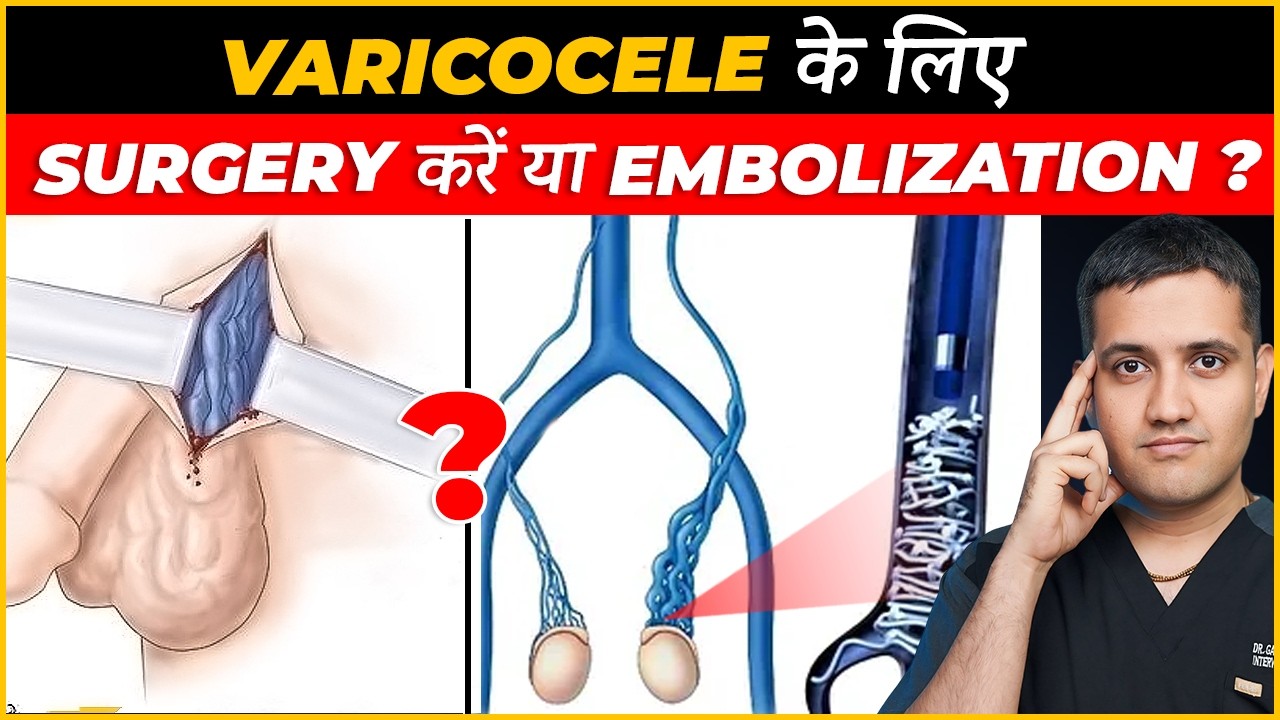 Varicocele | What are different treatment options, Which Is Better? | Dr. Gaurav Gangwani (IR)