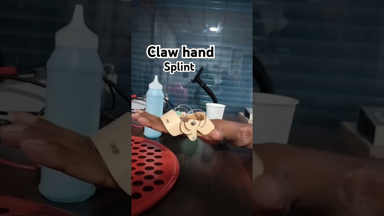 claw hand splint #physiotherapy #trending #exercise #youtubeshorts