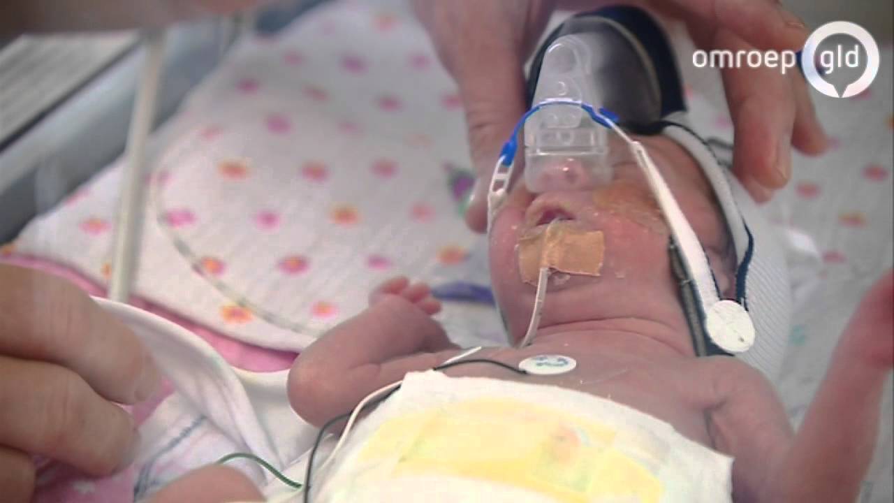 Artsen en verpleegkundigen zamelen geld in voor te vroeg geboren baby's