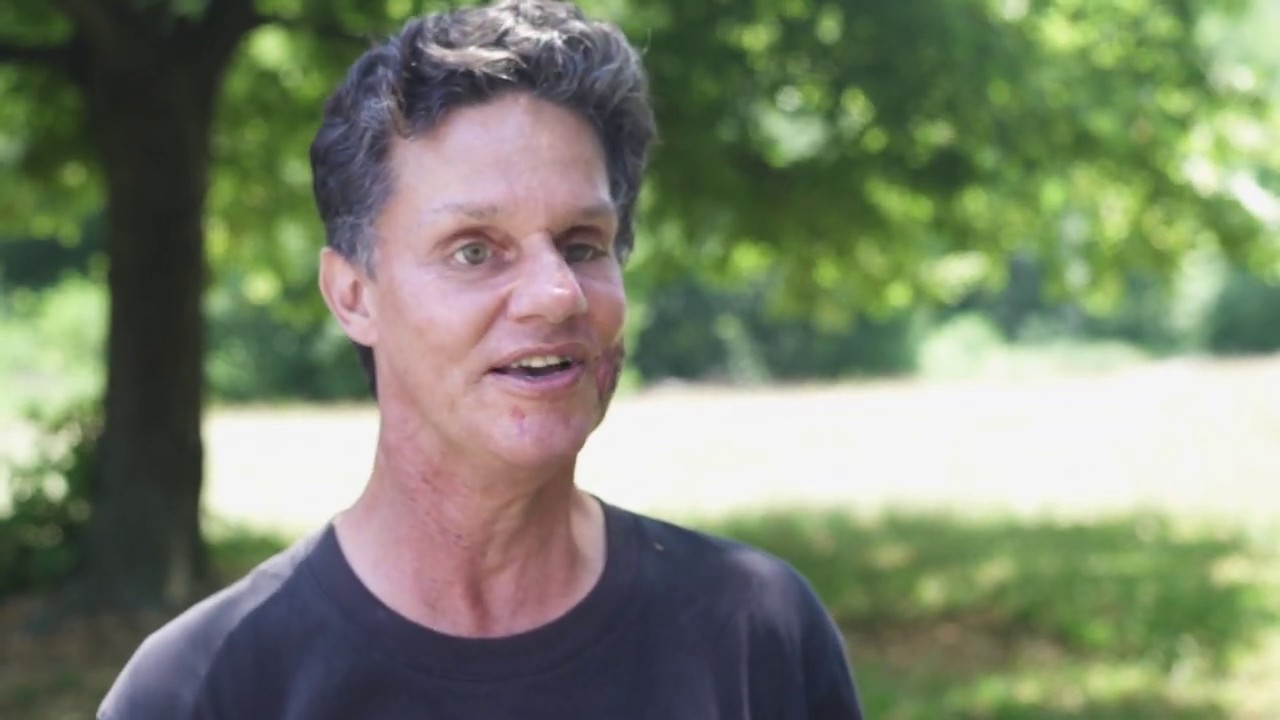 Wanderung und Picknick mit Daniel Kish und Juan Ruiz in Wien