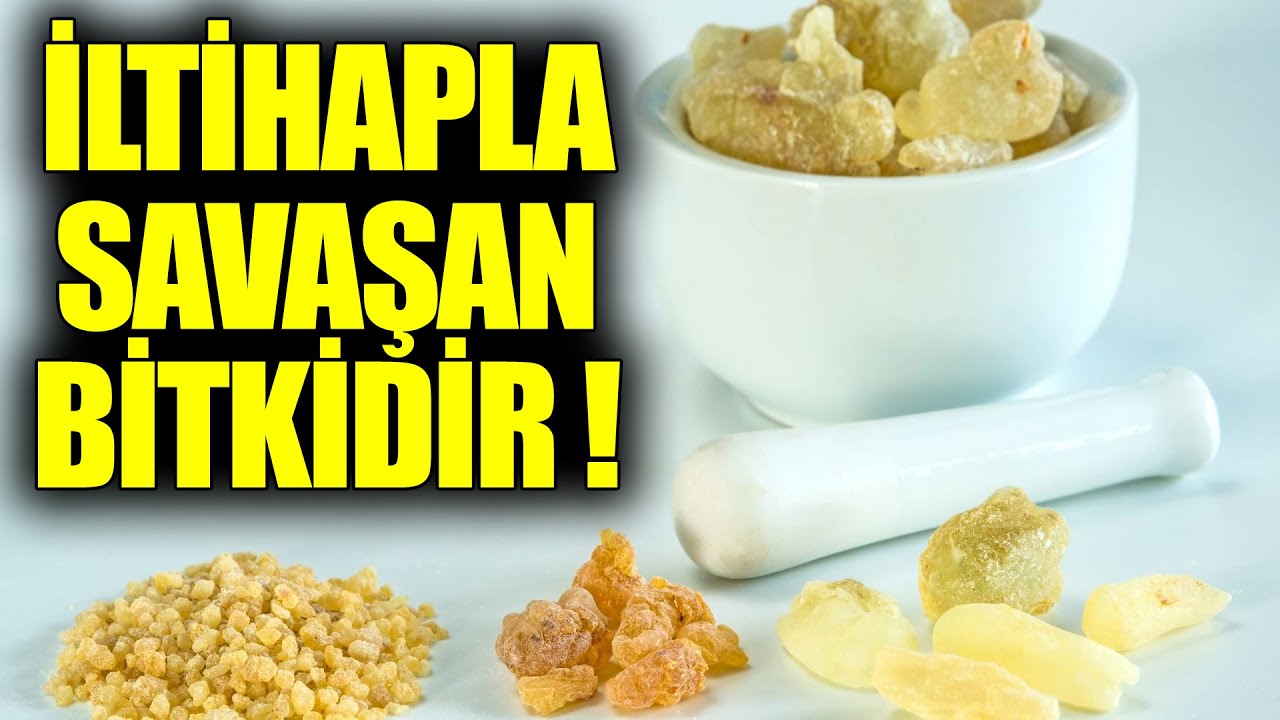 İltihapla Savaşan Bitki ! Günde 3 Tane Alın Tüm İltihapları Yok Etsin !