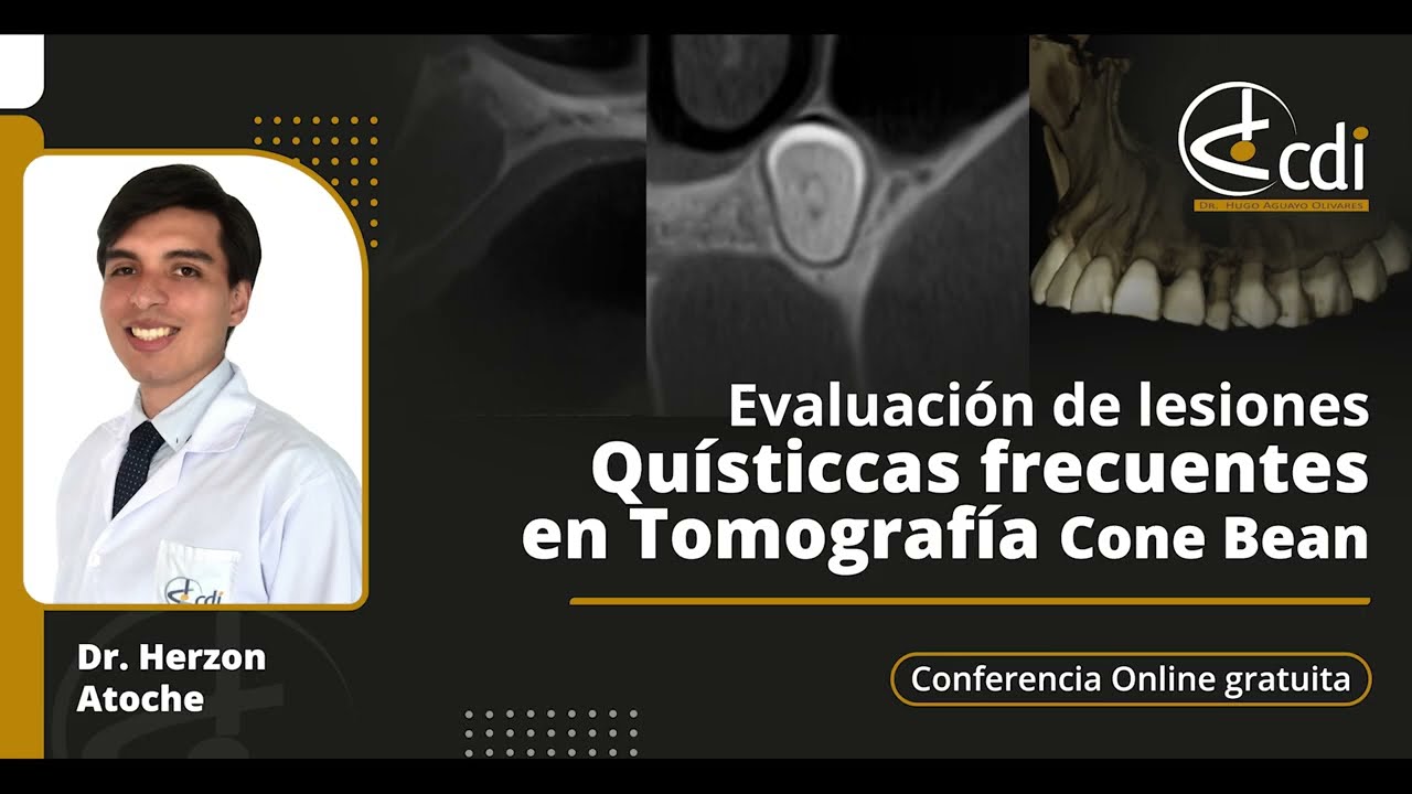 Conferencia OnlineEvaluación de lesiones Quísticas frecuentes en Tomografía Cone Beam