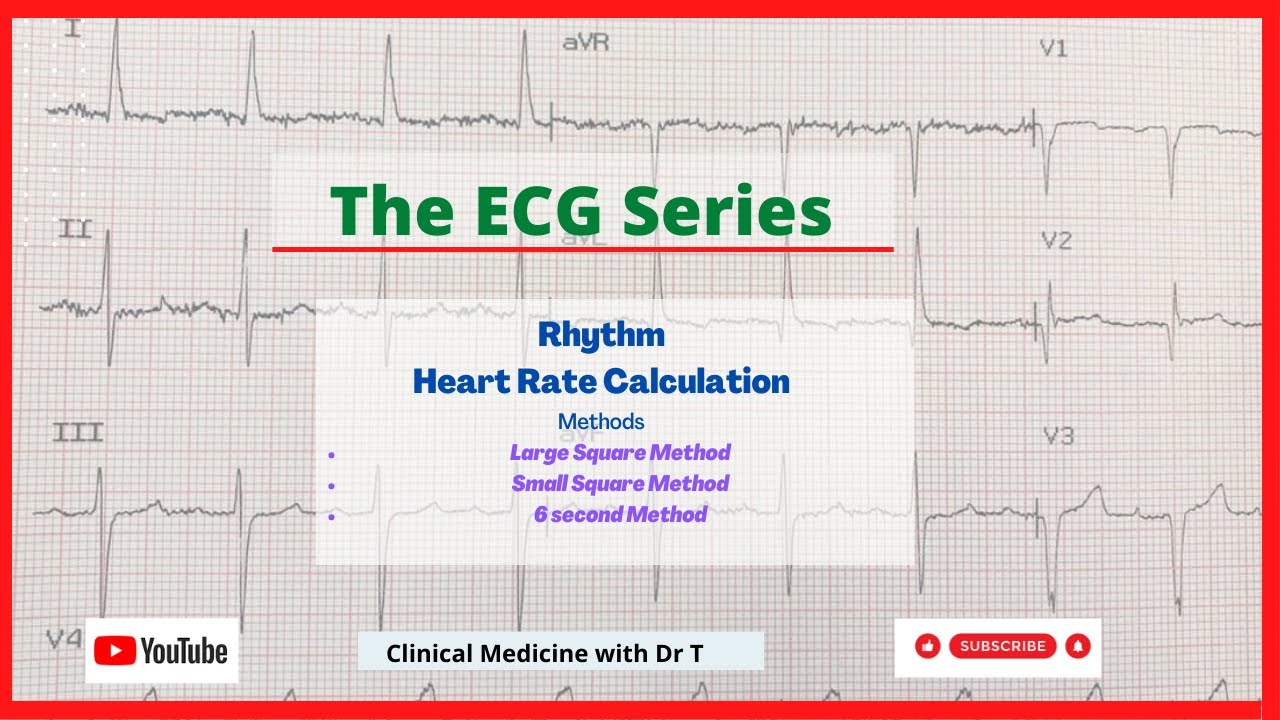 The ECG Series//Heart rate calculation//The 6 second method//Part2