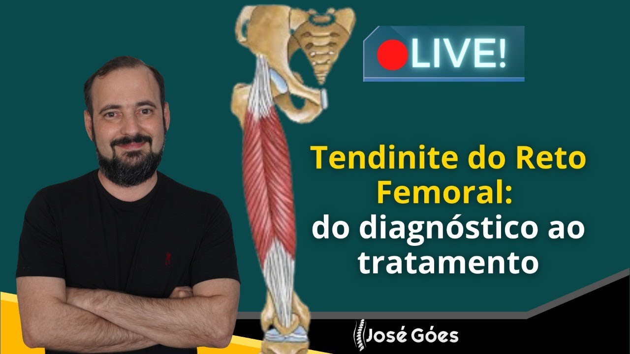LIVE Tendinite do Reto Femoral: do diagnóstico ao tratamento | José Góes