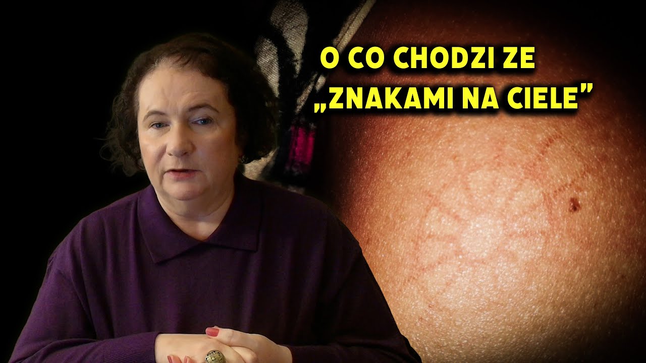 Znaki na ciele - masowy mit łączący  UFO, Atlantydę i Armagedon