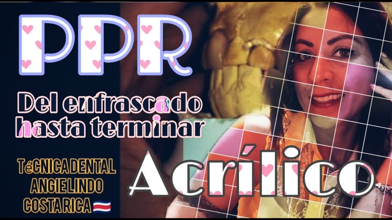 Tutorial Procesado Prótesis parcial clase magistral