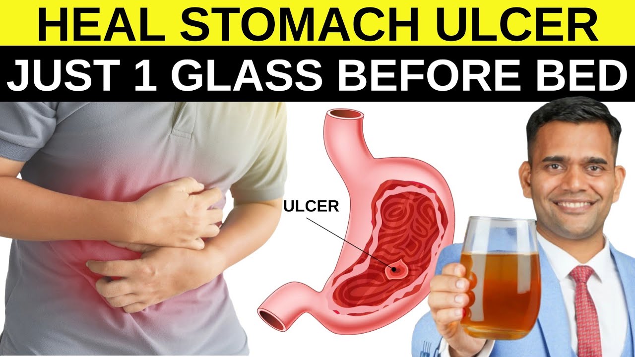 1 Glass Before Bed to Heal Stomach Ulcer Naturally at Home - Dr. Vivek Joshi 