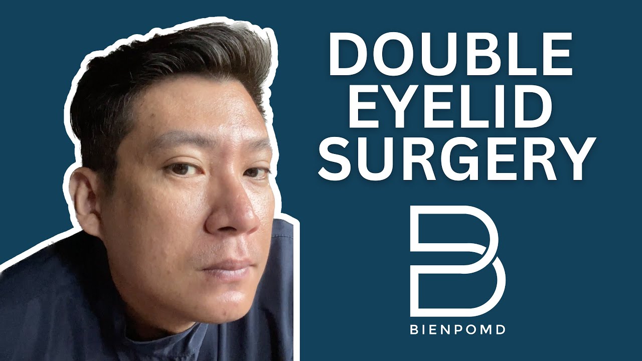 Pros and Cons ng Double Eyelid Surgery: Kailangan Mo Malaman